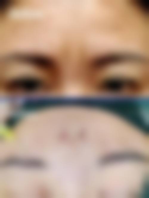 八、克拉玛依新颐美医疗美容诊所真实的患者评价