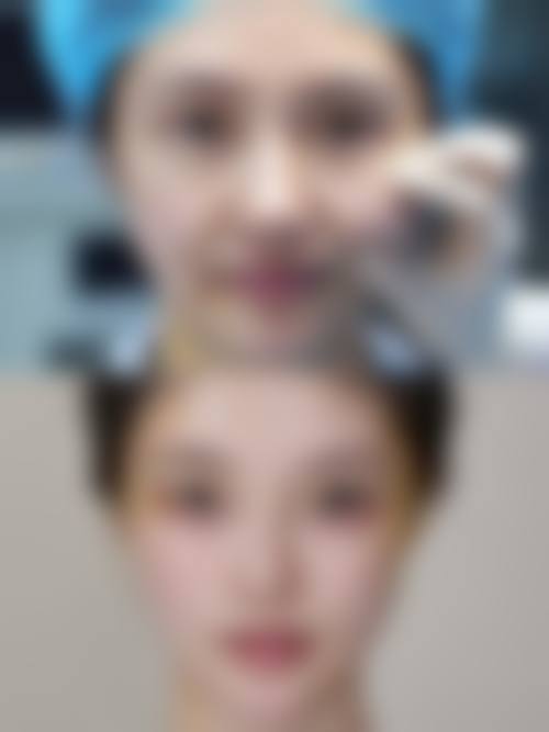 二、日照壹美天成整形美容医院怎么样？