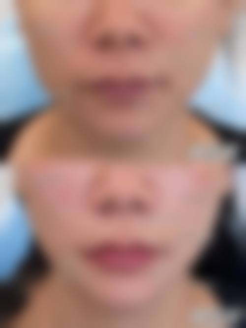 八、日照壹美天成整形美容医院预约方式