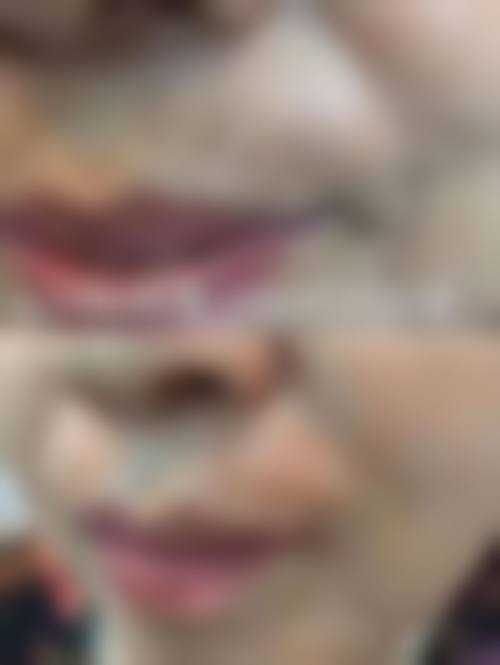 九、日照壹美天成整形美容医院真实的患者评价