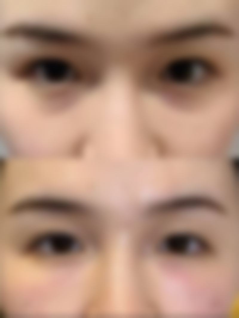 五、上海德琳医疗美容医院（男性私密中 心）相关项目