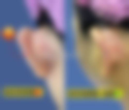 八、齐齐哈尔蝴蝶医疗美容诊所真实的患者评价