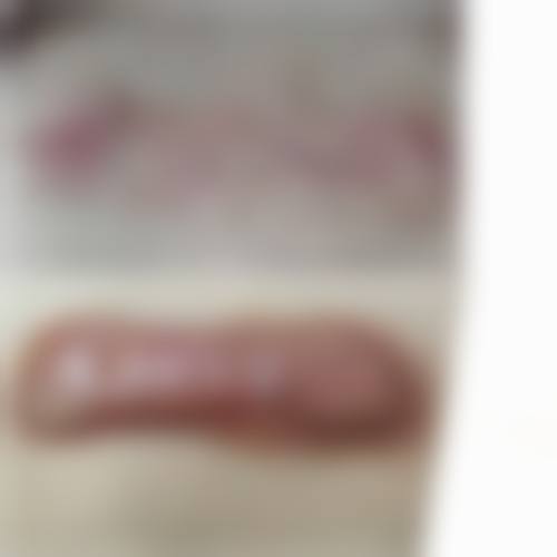 五、齐齐哈尔蝴蝶医疗美容诊所价格表