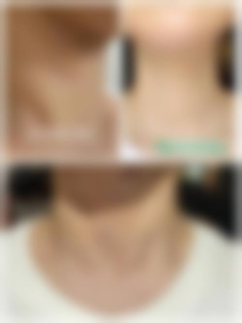 七、齐齐哈尔蝴蝶医疗美容诊所预约方式