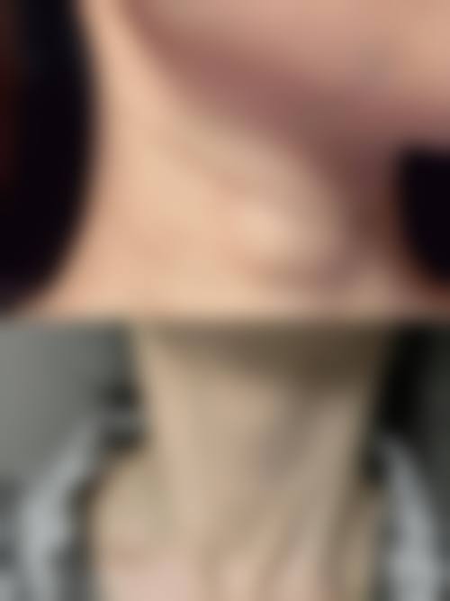 二、齐齐哈尔蝴蝶医疗美容诊所怎么样？