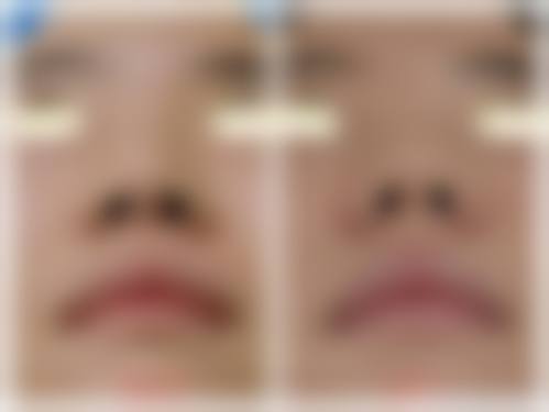 三、南昌韩美整形美容医院诊疗项目有哪些？