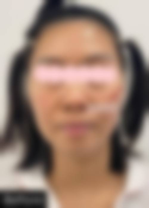 九、深圳睿恩医疗美容诊所真实的患者评价