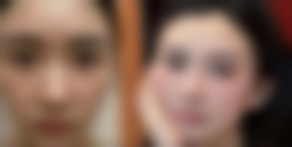 进口的有哪些瘦脸针品牌？保妥适、吉适等合法获批品牌大盘点