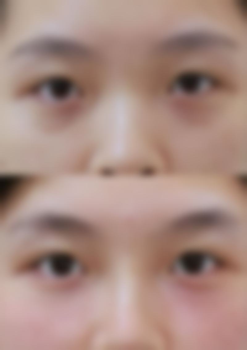 九、南昌韩美整形美容医院真实的患者评价