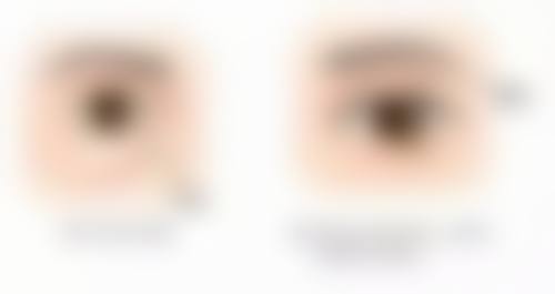 二、北京协和医院皮肤科——复杂增生疤痕的综合治疗高手