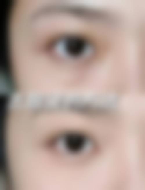 二、深圳优德医疗美容诊所怎么样？