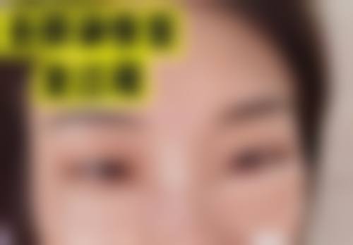 九、深圳优德医疗美容诊所真实的患者评价