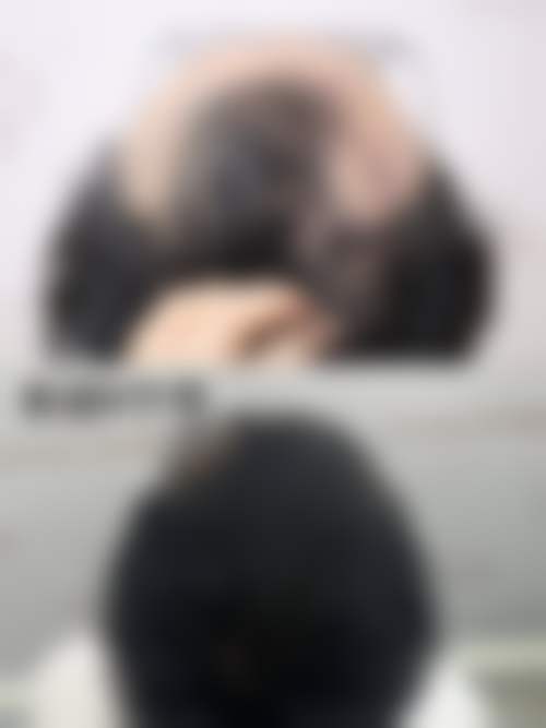 五、李康勇怎么预约？