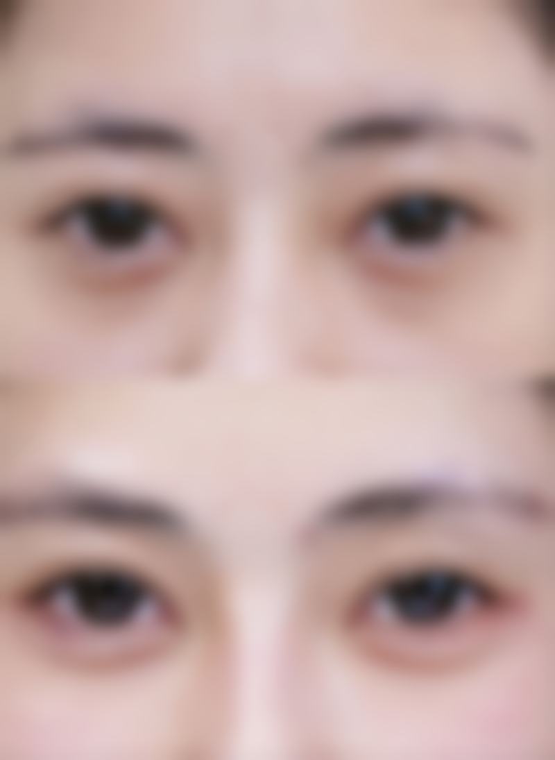 增生疤痕修复去哪儿做？南昌仁爱疤研等多家优质机构为您提供专业方案 