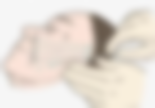 二、三点定位双眼皮重做的条件