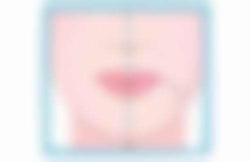 不开刀做眼袋能维持多久呢？术后护理好坏决定维持时间或1年到4年 