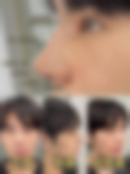 三、天津熙朵植发诊疗项目有哪些？