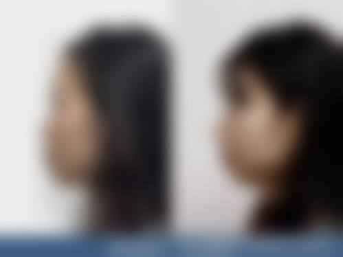 八、天津熙朵植发预约方式