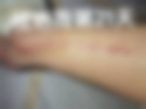 八、成都高新星鉴美肤整形医院真实的患者评价