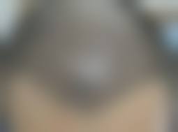 二、成都高新星鉴美肤整形医院怎么样？