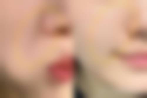 六、天津熙朵植发价格表