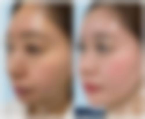 二、天津熙朵植发怎么样？