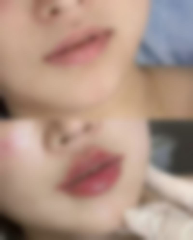 三、重庆赛格尔整形医院诊疗项目有哪些？