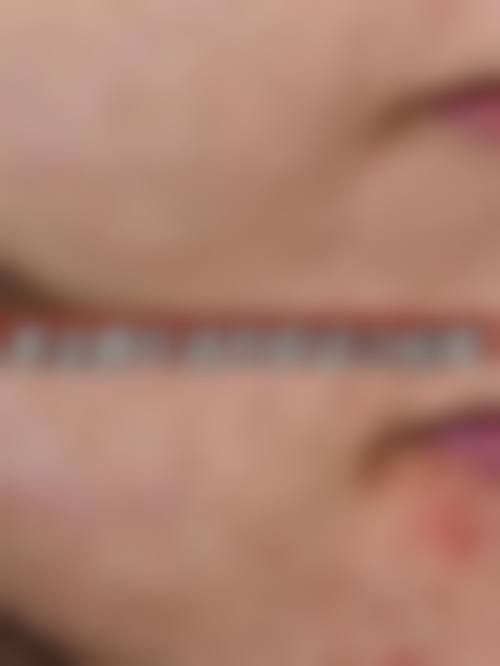 四、郑州大学第二附医院整形外科特色项目