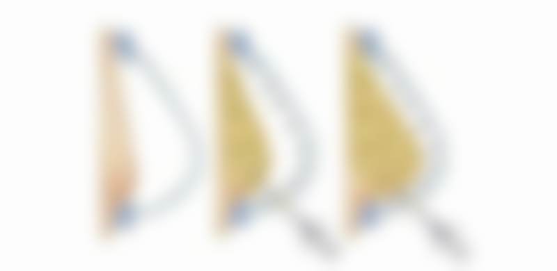 七、选择大连爱德丽格伊婉1ml玻尿酸除皱项目的理由