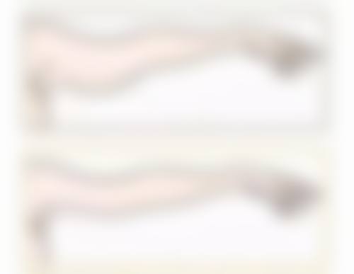 二、加强眼部护理，促进眼周健康