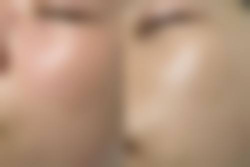 五、深圳康盈医疗美容门诊部价格表