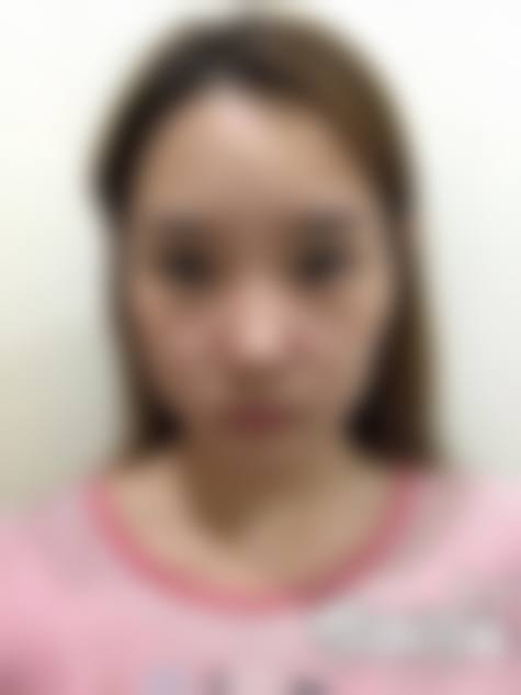 二、南宁雍禾植发医疗美容门诊部怎么样？