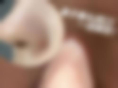 八、杭州华颜医疗美容门诊部真实的患者评价