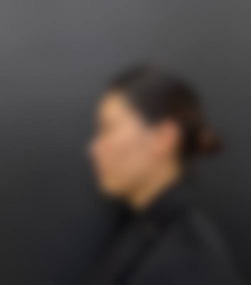 六、南宁雍禾植发医疗美容门诊部价格表