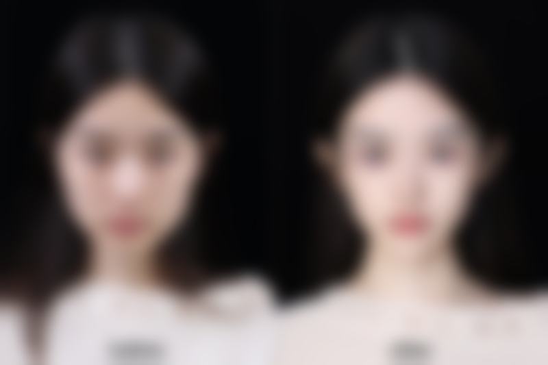 二、疤痕可以涂抹芦荟胶吗？芦荟胶对疤痕修复的原理