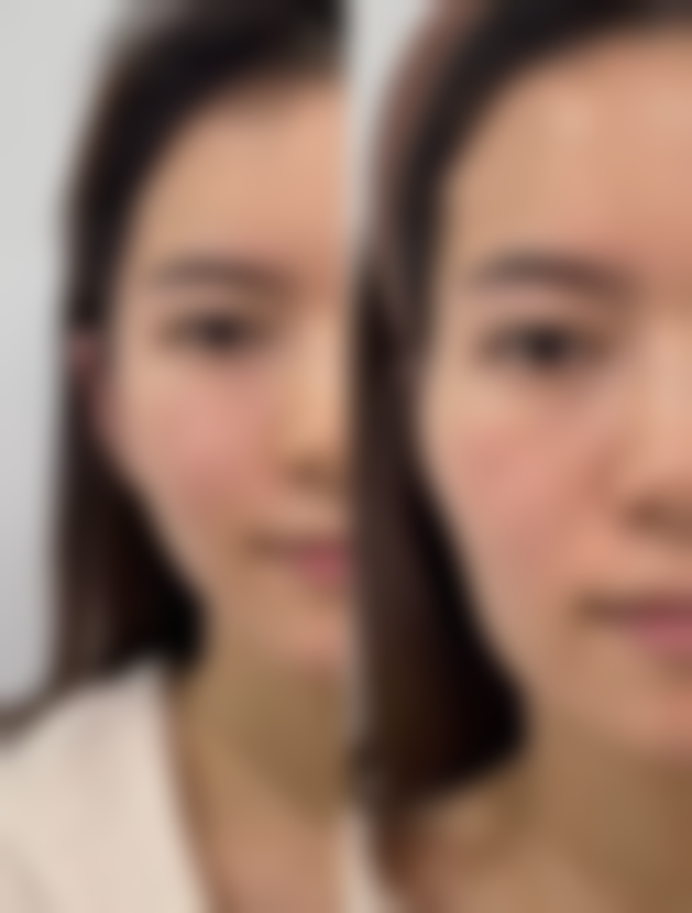 三、为什么外国人都是双眼皮？白种人双眼皮的原因