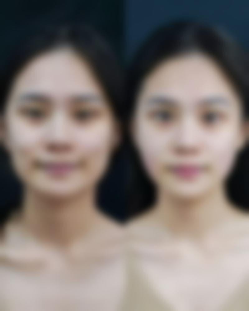 一、疤痕可以涂抹芦荟胶吗？了解疤痕与芦荟胶