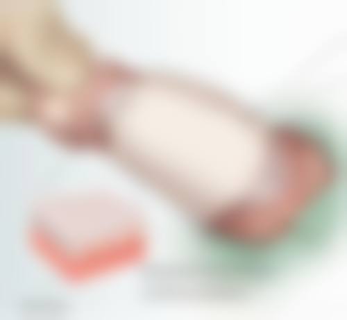 一、腹部吸脂常见的危害