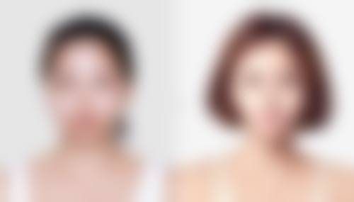 二、影响超声去眼袋修复时间的因素