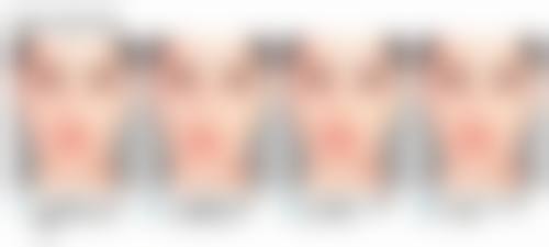 四、小孩额头上有疤痕怎么去除之外科手术