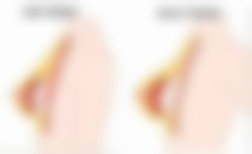 一、打瘦脸针到底有没有用之瘦脸针的原理