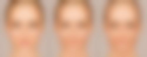 三、打瘦脸针到底有没有用之适用人群