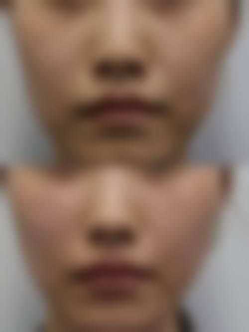 三、南京春语医疗美容诊所诊疗项目有哪些？