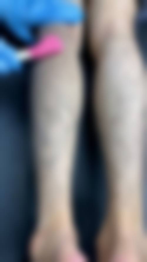 八、南京春语医疗美容诊所真实的患者评价