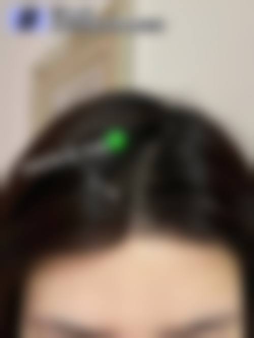 八、长沙晶肤医疗美容医院（书院南路院）真实的患者评价