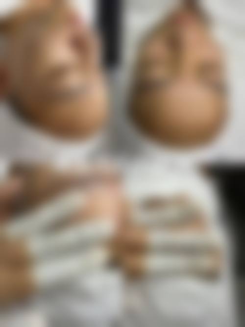 五、南京春语医疗美容诊所价格表