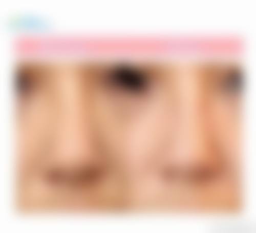 二、连云港俏嘉丽医颜整形医院怎么样？