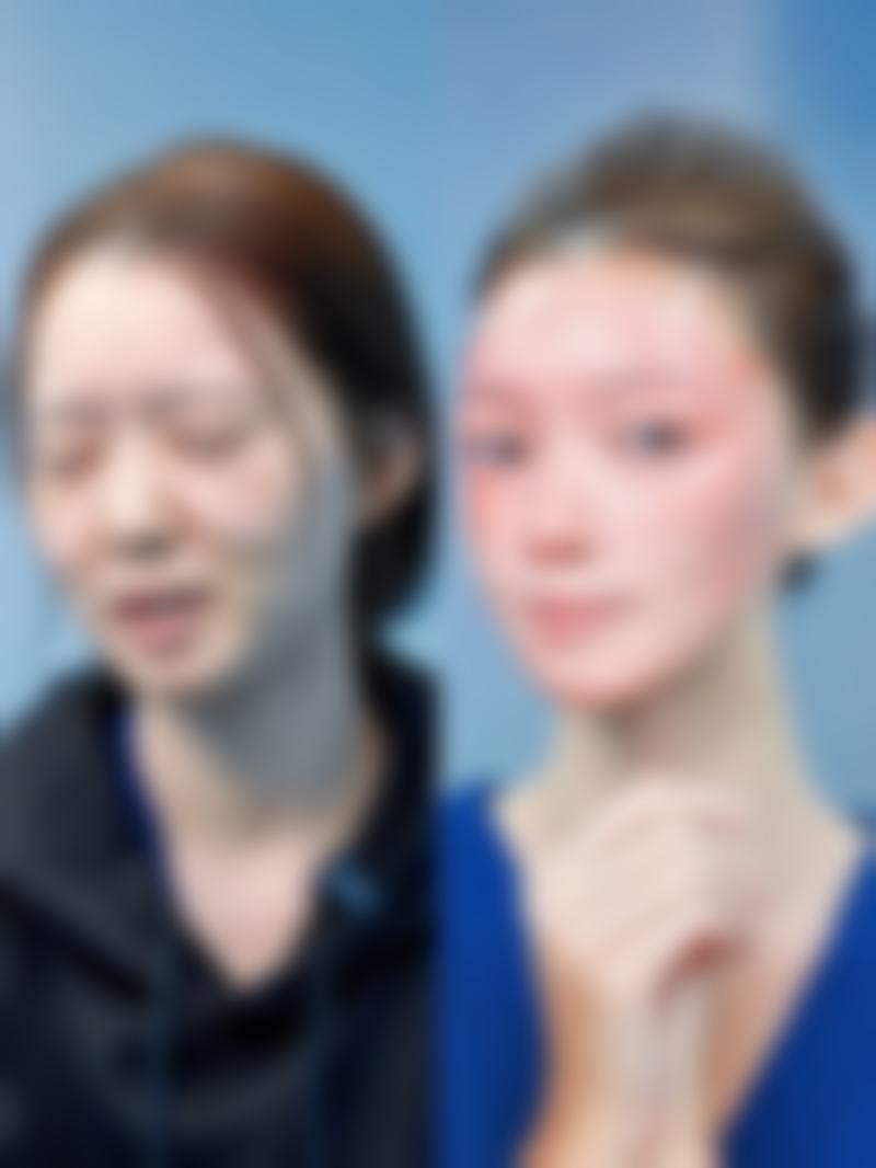 腹部吸脂对身体有影响吗？了解腹部吸脂手术的危害和后遗症很重要！ 