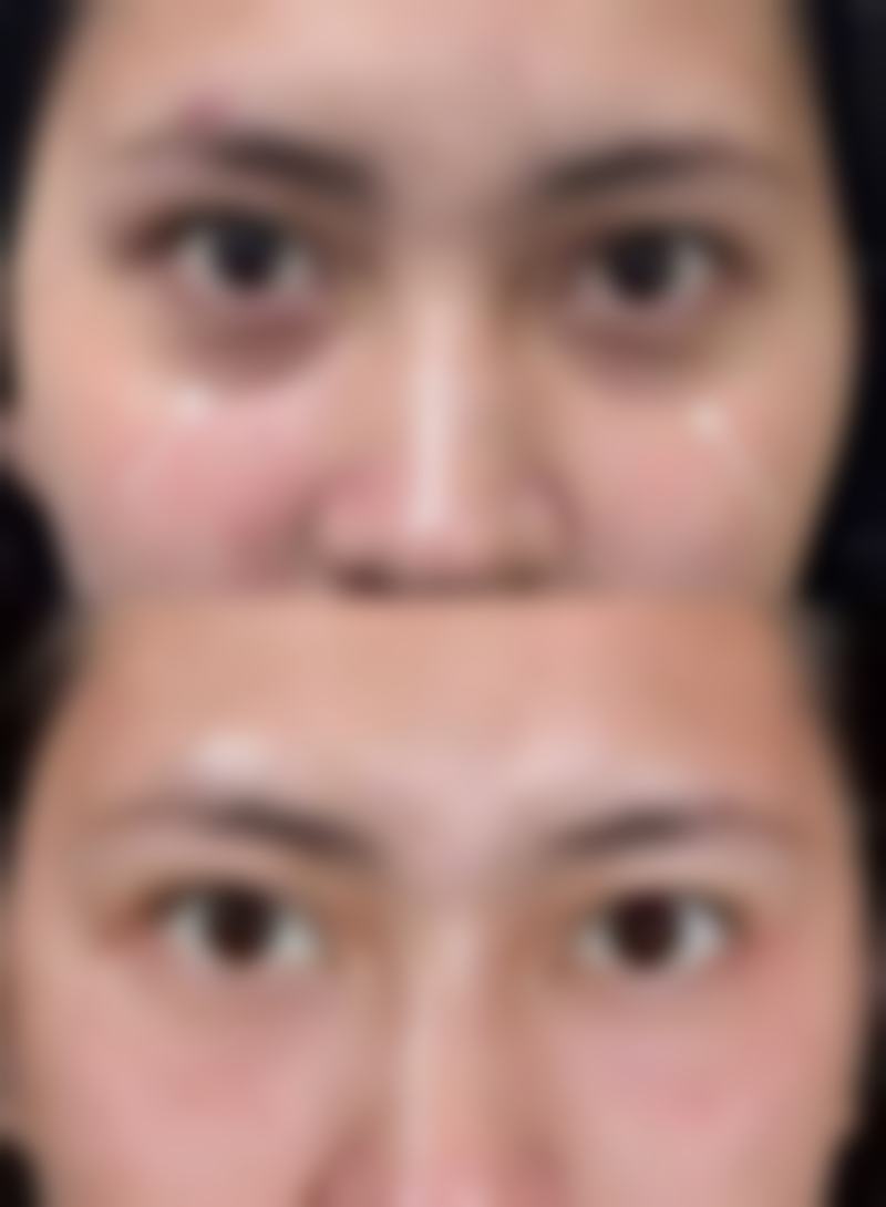 三、不同阶段的修复表现