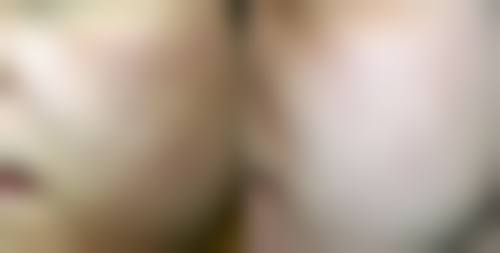 三、日常护理要点